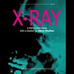 X-Ray by Ben Harris and Steve Shufton - Book