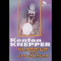Sponge Balls Like Never Before video DOWNLOAD (Excerpt of Klose-Up And Unpublished by Kenton Knepper - DVD)